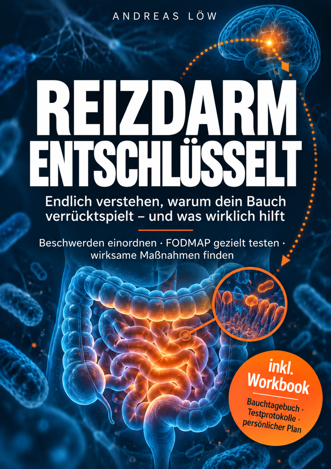 Buchcover: Reizdarm entschlüsselt